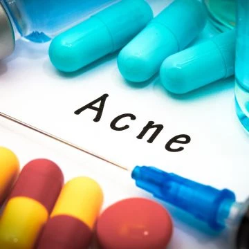 Il triamcinolone acetonide è buono per l'acne
